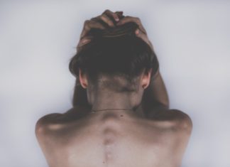 Alopecia femminile: cause e rimedi Alopecia femminile
