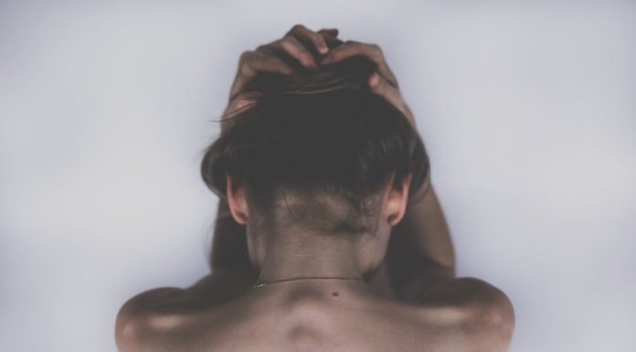 Alopecia femminile: cause e rimedi Alopecia femminile